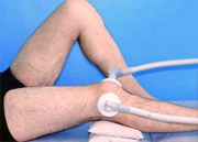 физиопроцедуры снизят боль и увеличат приток крови к колену